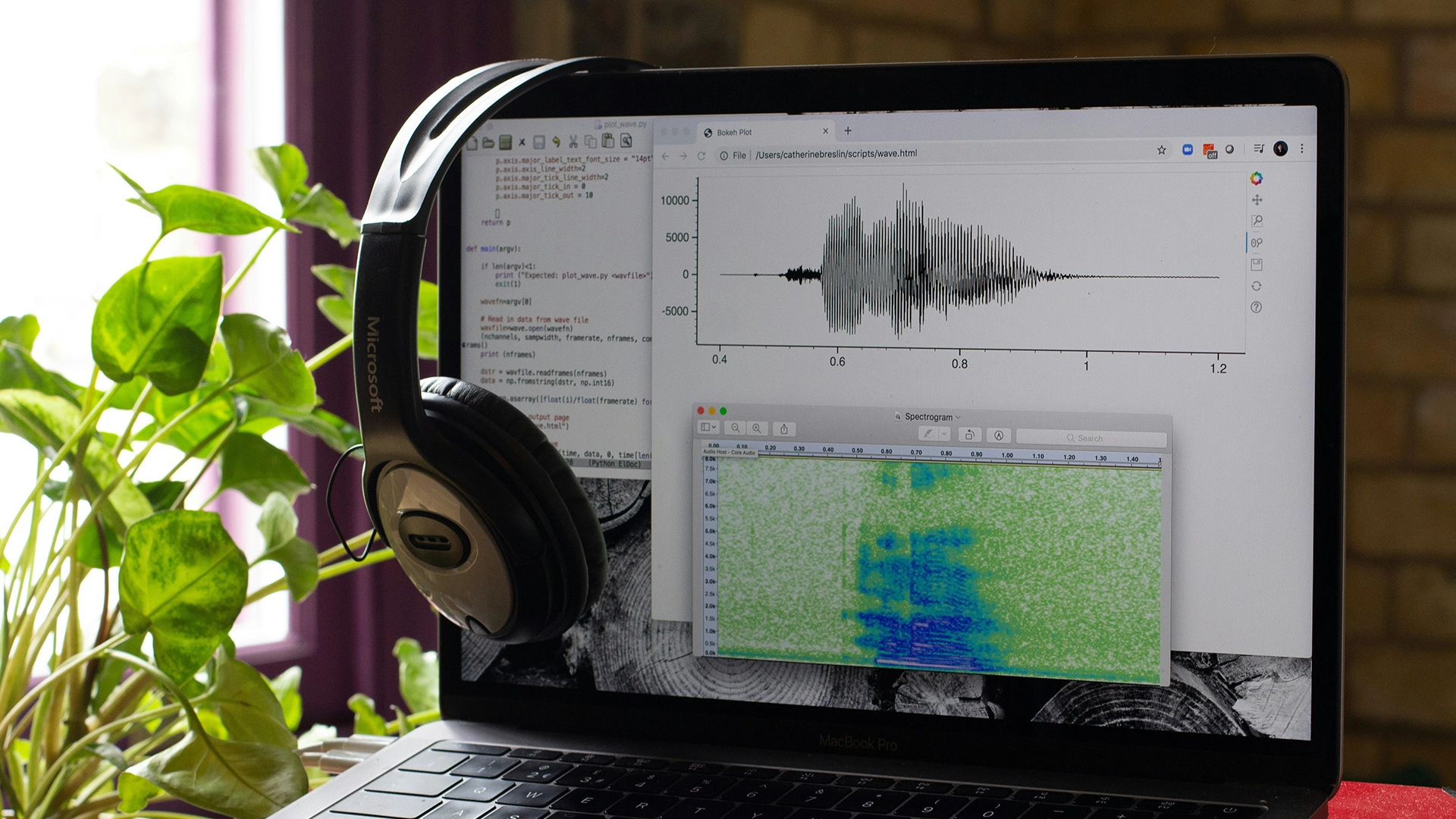 AI Restores Her Voice Post-Cancer, but Coverage Remains Out Of Reach